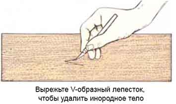 Удаление инородного тела на шпоне